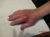 Dennis-Hand